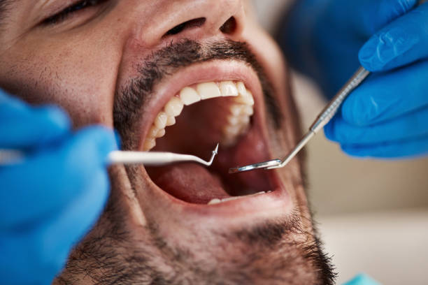 Best Cosmetic Emergency Dentistry in Mahomet, IL