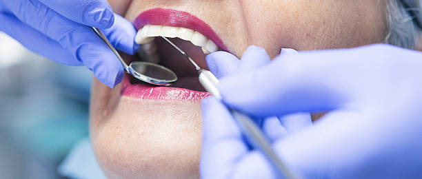 Best Emergency Wisdom Teeth Removal in Mahomet, IL